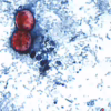 Greenhouse-grown produce gains attention as Cyclospora investigation continues